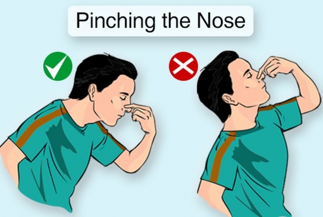Причины носового кровотечения у детей и взрослых