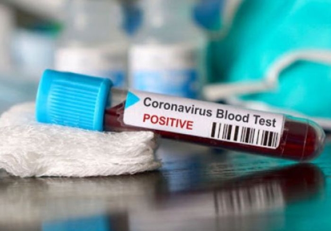 Ученые: коронавирус снижает уровень интеллекта больше, чем инсульт