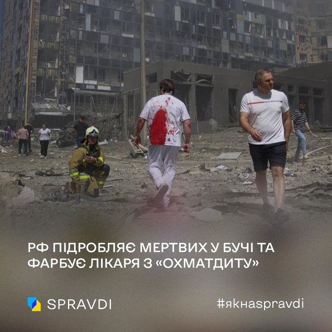 Пропаганда зомбує росіян тим, що удар по «Охматдиту» – це постановка і бутафорія